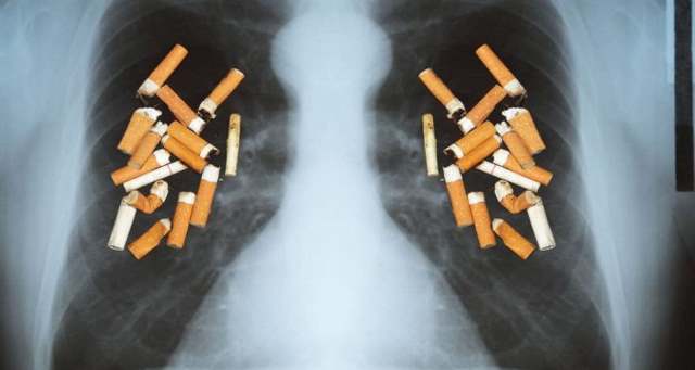 肺の中にタバコ