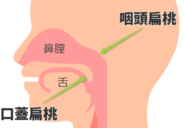 咽頭扁桃（アデノイド）と口蓋扁桃